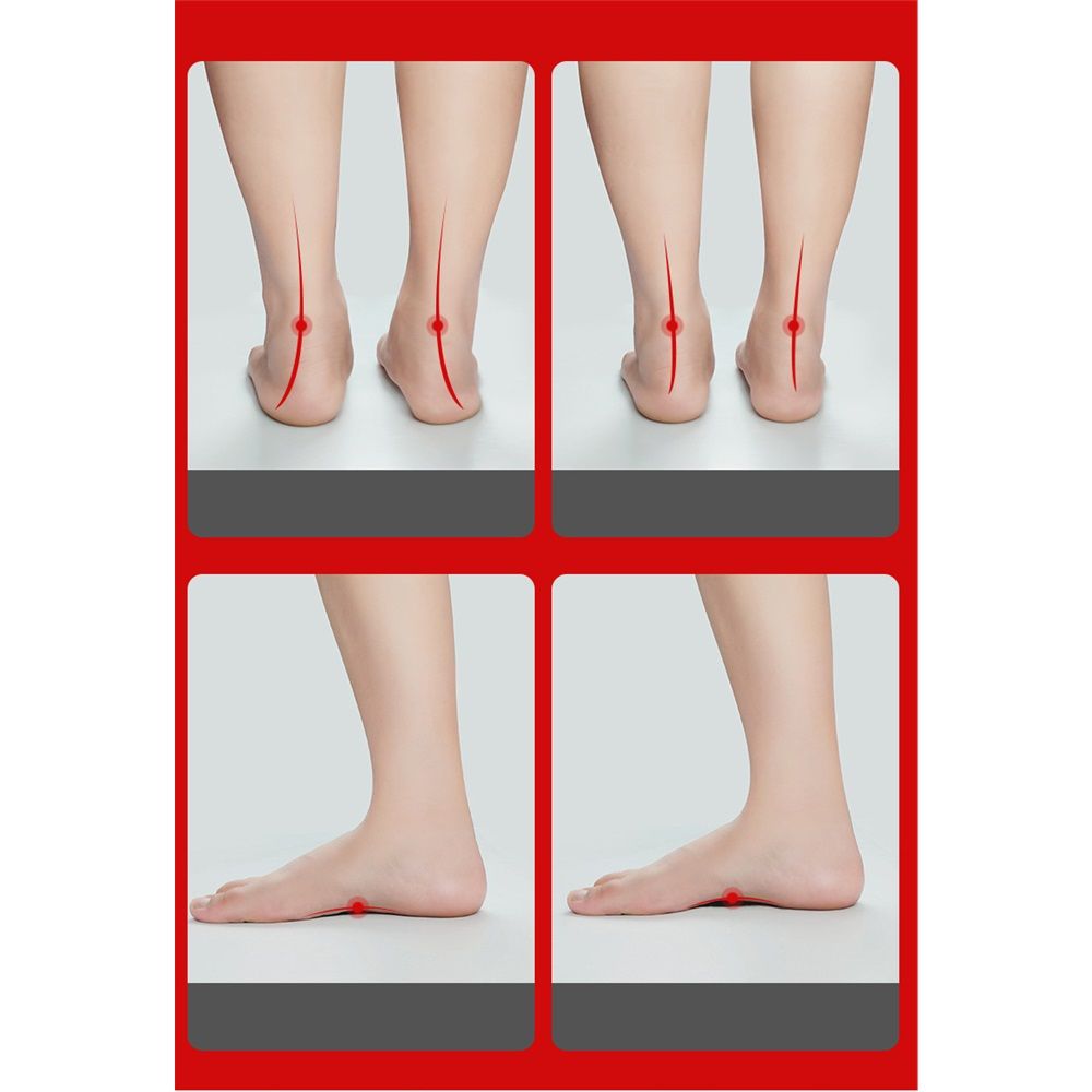 Shoe Pads 1 Pair Arch Support Inserts Plantar Insoles for Flatfoot Corrector view 5
