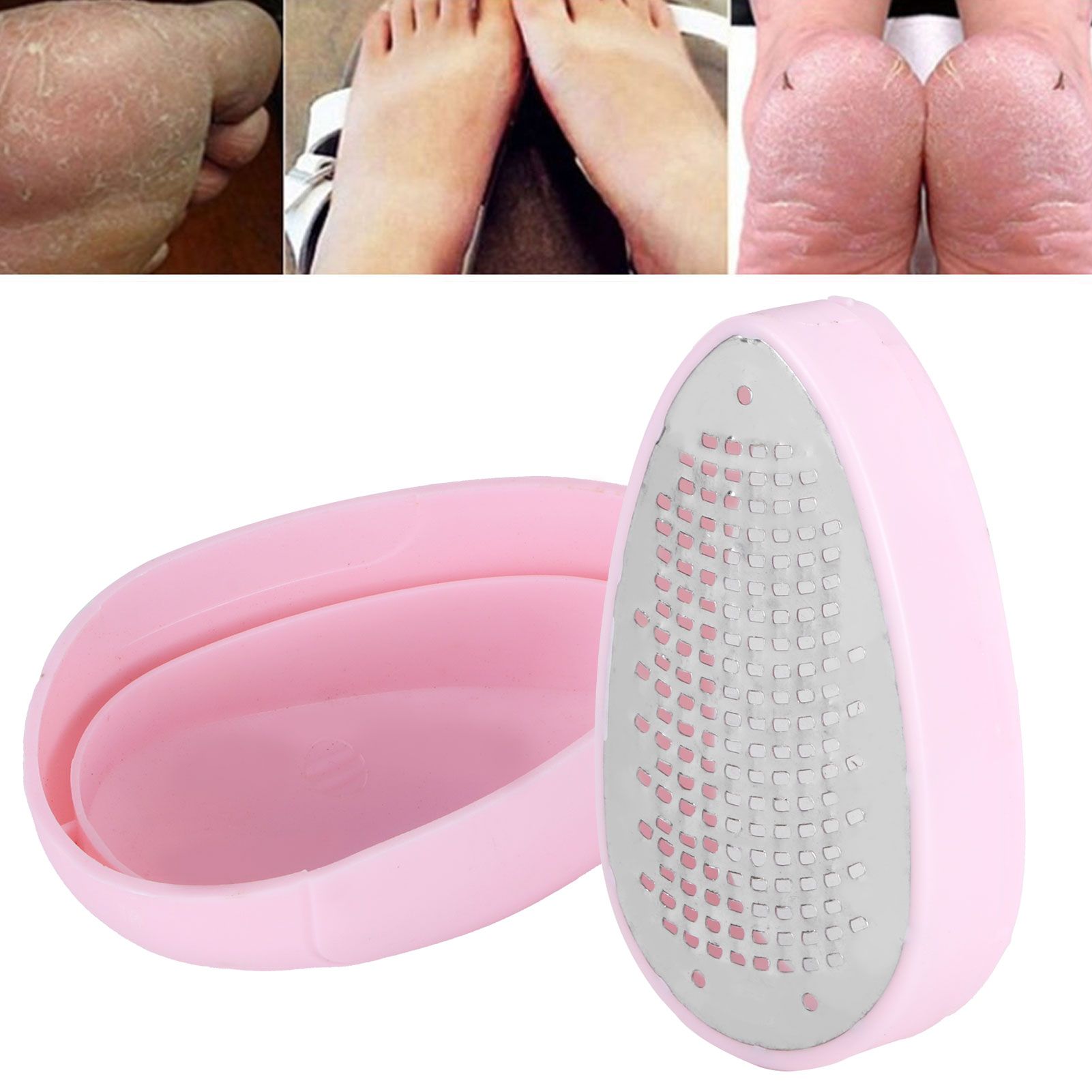 Manual Foot File Household Feet Callus Dead Skin Remover Tool Foot Care view 9