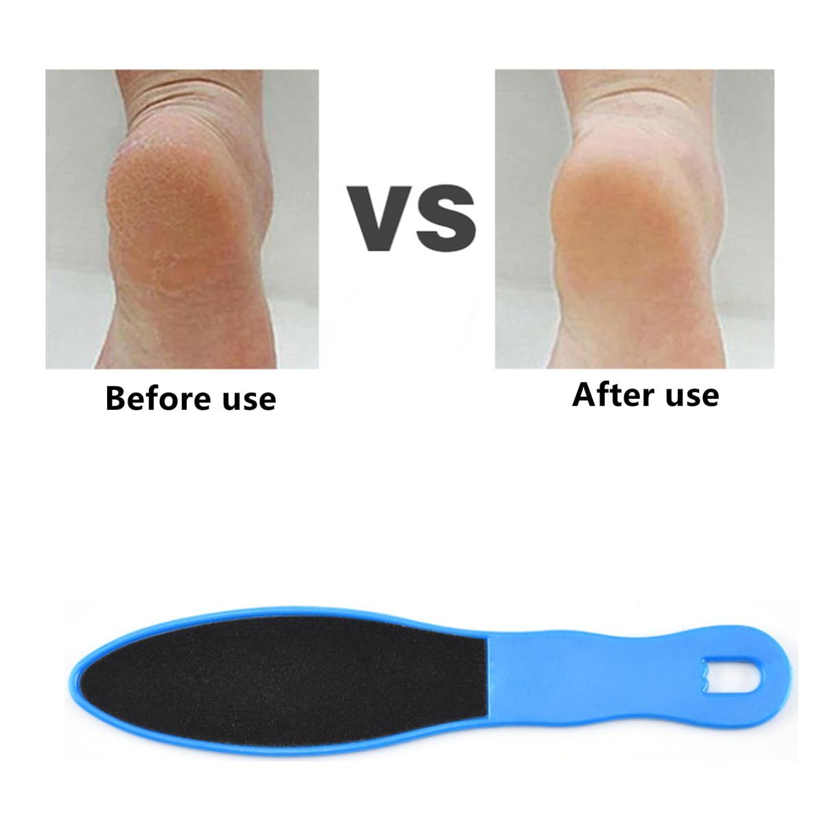 2pcs Double-Sided Foot Scraper view 5