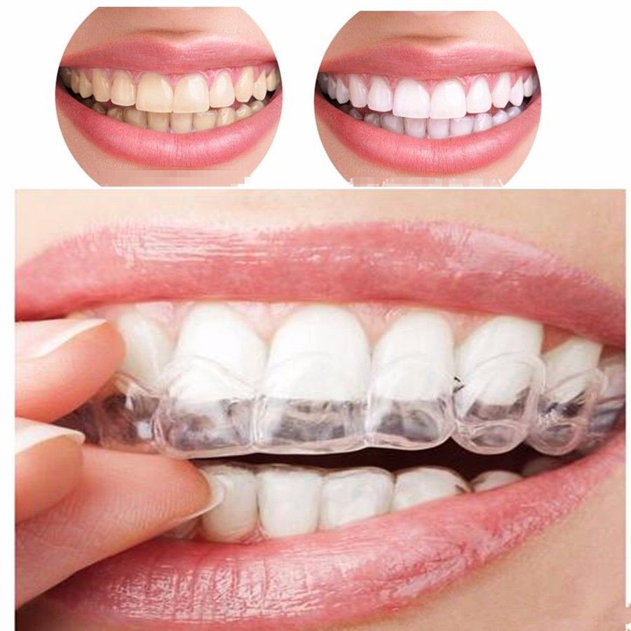 Retainer, Dental Retainer for Teeth, Retainers Nearly Invisible, Clear view 2