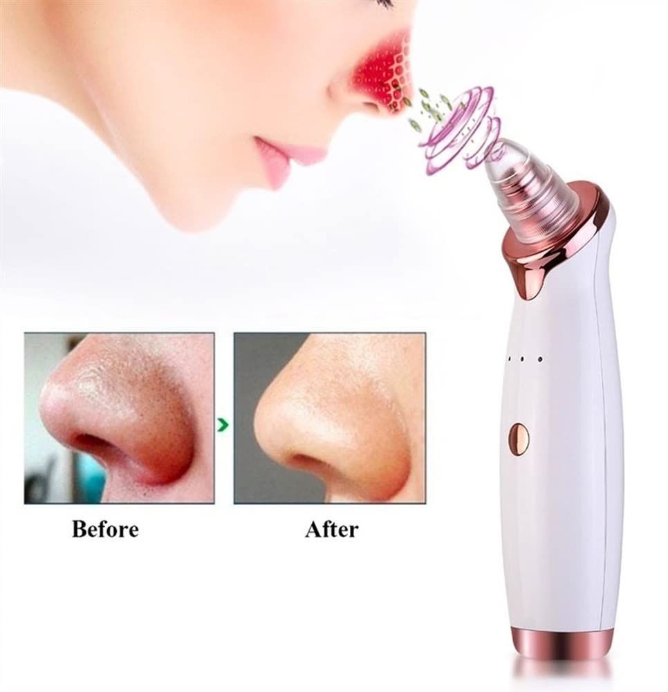 Blackhead Remover Pore Vacuum view 2
