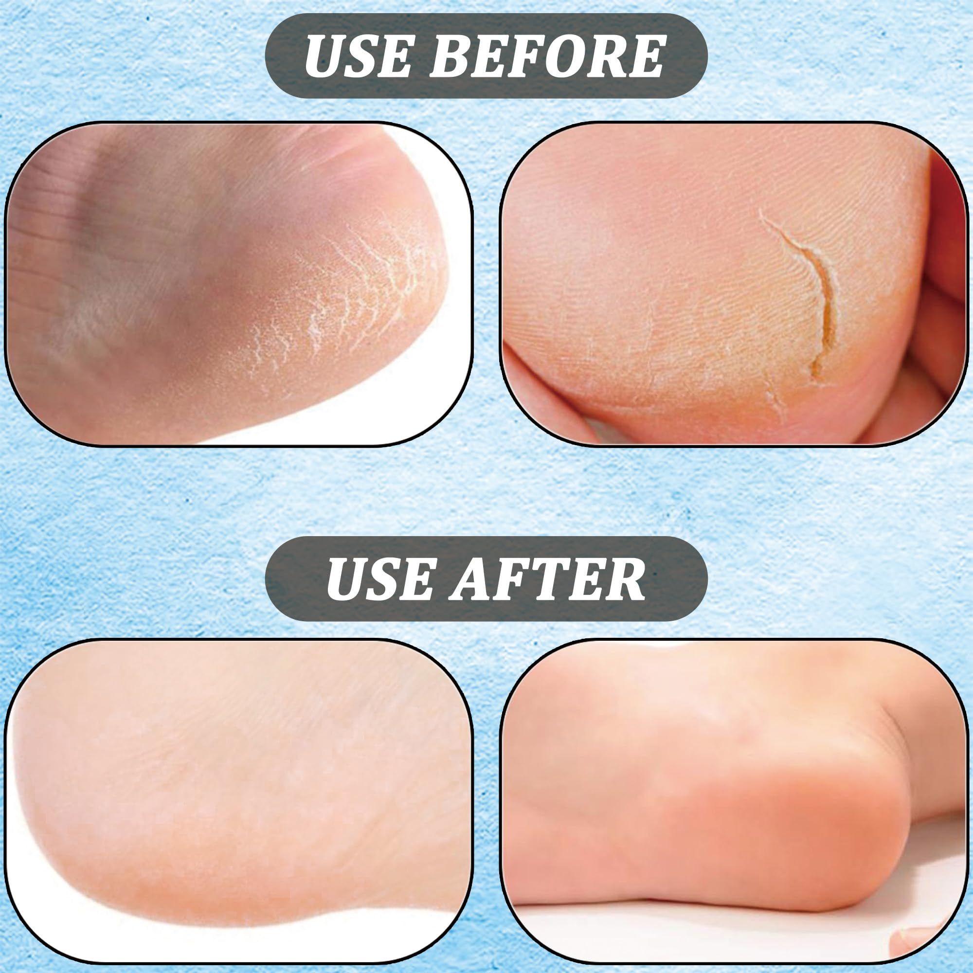 Silicone Moisturizing Socks Spa Pedicure Silicone Socks Foot Care Soft Gel view 4