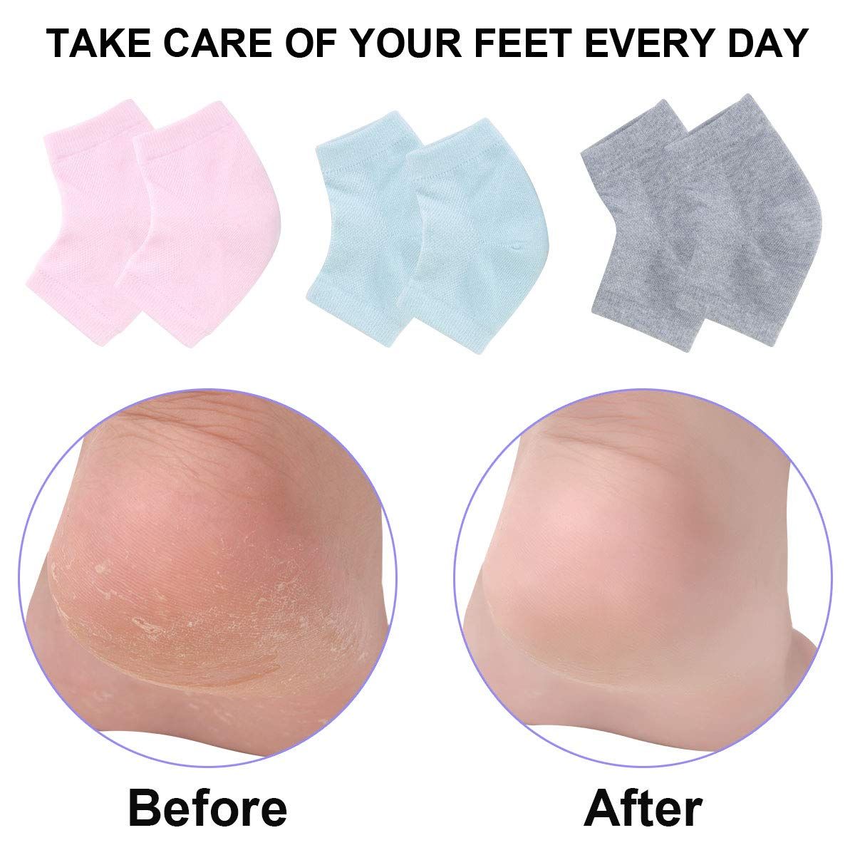 Vented Moisturizing Gel Heel Socks view 4