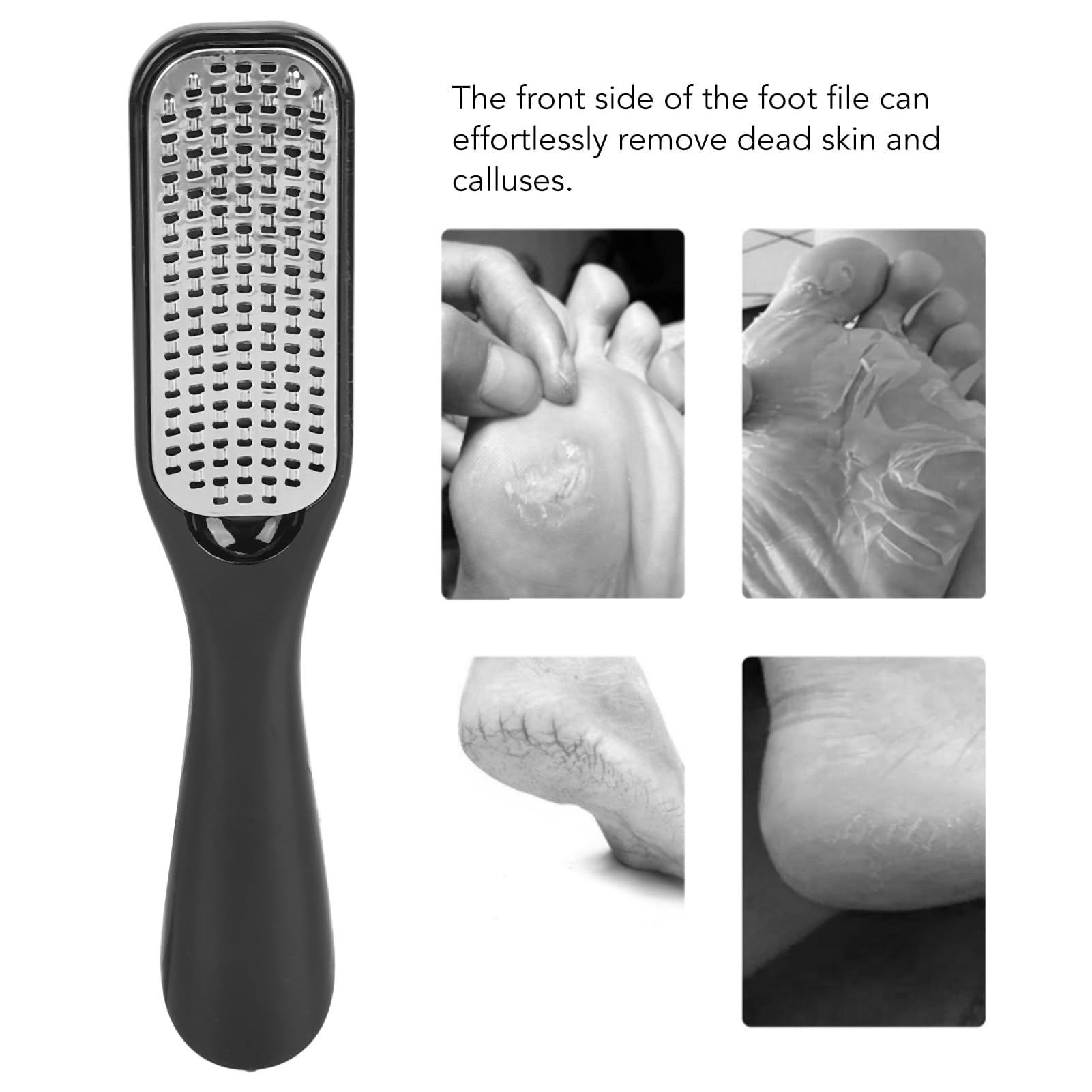 Double Sided Foot Scraper Callus Remover view 5