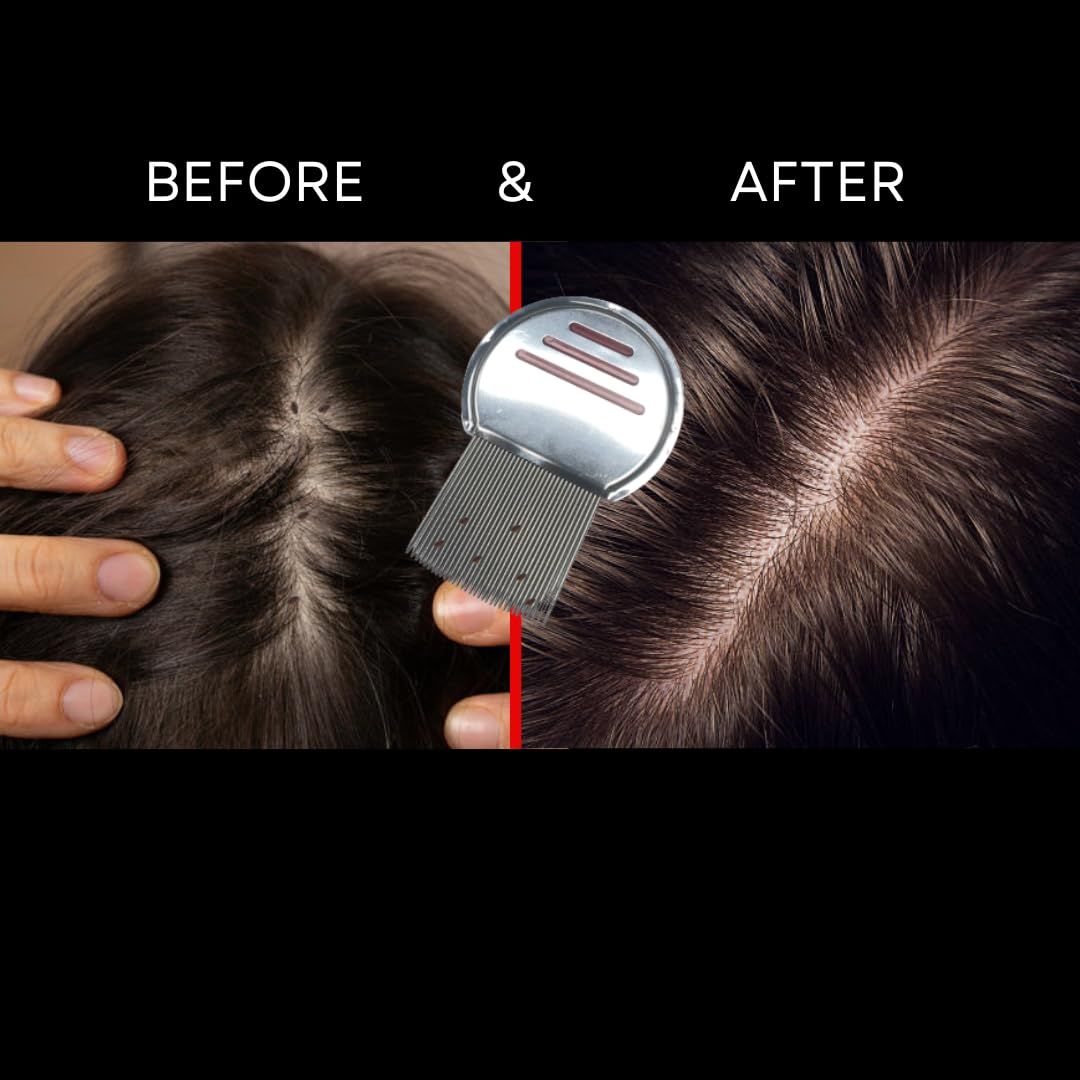 Pet supplies flea removal comb pet brush 304 stainless steel three bar view 3
