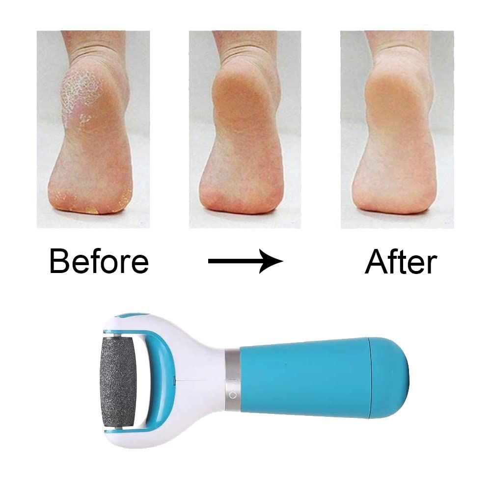 Electric Foot File Professional Hard Skin Remover Foot Care Skin Remover for view 3